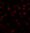 Calcium-transporting ATPase type 2C member 2 antibody, A09207, Boster Biological Technology, Immunofluorescence image 