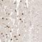 Proteasome 26S Subunit, Non-ATPase 6 antibody, NBP1-81545, Novus Biologicals, Immunohistochemistry frozen image 