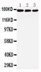 Low-density lipoprotein receptor-related protein 5 antibody, LS-C313365, Lifespan Biosciences, Western Blot image 