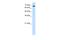 Ribophorin II antibody, A05006, Boster Biological Technology, Western Blot image 