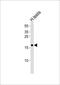 SPANX Family Member A2 antibody, PA5-49362, Invitrogen Antibodies, Western Blot image 