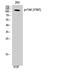 Protein Tyrosine Kinase 2 antibody, STJ90675, St John
