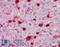 S100 Calcium Binding Protein A9 antibody, LS-B3613, Lifespan Biosciences, Immunohistochemistry paraffin image 