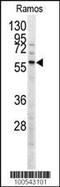 Menin 1 antibody, MBS9203393, MyBioSource, Western Blot image 