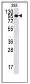 Collagen Type IX Alpha 1 Chain antibody, AP12402PU-N, Origene, Western Blot image 