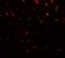 Transmembrane And Immunoglobulin Domain Containing 1 antibody, GTX32126, GeneTex, Immunohistochemistry paraffin image 