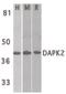 Death-associated protein kinase 2 antibody, orb86754, Biorbyt, Western Blot image 