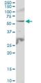 Interleukin 6 Receptor antibody, H00003570-B01P, Novus Biologicals, Western Blot image 