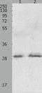 GTP Cyclohydrolase 1 antibody, TA321072, Origene, Western Blot image 