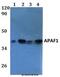 Apoptotic Peptidase Activating Factor 1 antibody, LS-C411994, Lifespan Biosciences, Western Blot image 