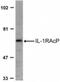 Interleukin 1 Receptor Accessory Protein antibody, NBP1-76464, Novus Biologicals, Western Blot image 