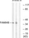 LRAT Domain Containing 2 antibody, LS-C119213, Lifespan Biosciences, Western Blot image 