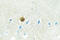 p53 antibody, LS-C176721, Lifespan Biosciences, Immunohistochemistry paraffin image 