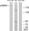 Laminin Subunit Alpha 4 antibody, PA5-38938, Invitrogen Antibodies, Western Blot image 