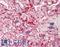 Mohawk Homeobox antibody, LS-C674339, Lifespan Biosciences, Immunohistochemistry paraffin image 