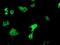 Oxidoreductase NAD Binding Domain Containing 1 antibody, NBP2-00916, Novus Biologicals, Immunocytochemistry image 