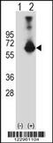 Cystathionine-Beta-Synthase antibody, 62-560, ProSci, Western Blot image 