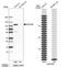 DNA Methyltransferase 3 Beta antibody, NBP1-85815, Novus Biologicals, Western Blot image 