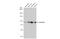 Signal Transducer And Activator Of Transcription 5B antibody, GTX01153, GeneTex, Western Blot image 