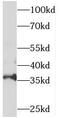 Sorting Nexin 20 antibody, FNab08087, FineTest, Western Blot image 