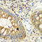 Protein Interacting With PRKCA 1 antibody, LS-C331510, Lifespan Biosciences, Immunohistochemistry frozen image 