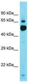 Kelch Repeat And BTB Domain Containing 11 antibody, TA337370, Origene, Western Blot image 