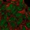 Kinase D Interacting Substrate 220 antibody, NBP1-88995, Novus Biologicals, Immunofluorescence image 