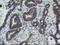 Archain 1 antibody, M08725-1, Boster Biological Technology, Immunohistochemistry paraffin image 