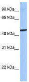 Guanylate Binding Protein 4 antibody, TA340223, Origene, Western Blot image 