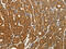 Patched 1 antibody, CSB-PA179507, Cusabio, Immunohistochemistry paraffin image 