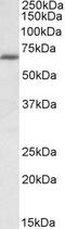 IKAROS Family Zinc Finger 1 antibody, PA5-19214, Invitrogen Antibodies, Western Blot image 
