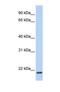 Transmembrane Protein 35A antibody, NBP1-69343, Novus Biologicals, Western Blot image 