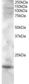 Cystatin F antibody, 45-451, ProSci, Western Blot image 