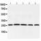 Adiponectin, C1Q And Collagen Domain Containing antibody, LS-C313404, Lifespan Biosciences, Western Blot image 