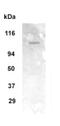 Glutamate Metabotropic Receptor 1 antibody, ab82211, Abcam, Western Blot image 