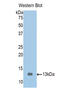 E-Tmod antibody, LS-C296807, Lifespan Biosciences, Western Blot image 