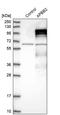 Amyloid beta A4 precursor protein-binding family B member 2 antibody, PA5-54816, Invitrogen Antibodies, Western Blot image 