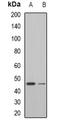 Helicase, Lymphoid Specific antibody, orb340983, Biorbyt, Western Blot image 