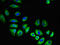 FGR Proto-Oncogene, Src Family Tyrosine Kinase antibody, LS-C677948, Lifespan Biosciences, Immunofluorescence image 