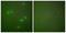 Cyclin-dependent kinase inhibitor 2A antibody, LS-C118541, Lifespan Biosciences, Immunofluorescence image 