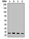 Clathrin Light Chain B antibody, LS-C668219, Lifespan Biosciences, Western Blot image 