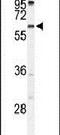 Transmembrane Protein 108 antibody, PA5-26603, Invitrogen Antibodies, Western Blot image 