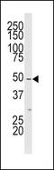 Mitogen-Activated Protein Kinase Kinase Kinase 20 antibody, PA5-15331, Invitrogen Antibodies, Western Blot image 