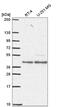 Estrogen Related Receptor Alpha antibody, NBP2-56812, Novus Biologicals, Western Blot image 