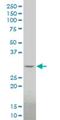 Distal-Less Homeobox 1 antibody, H00001745-M15, Novus Biologicals, Western Blot image 