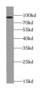 Transforming Growth Factor Beta Receptor 3 antibody, FNab08645, FineTest, Western Blot image 