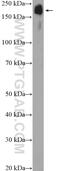 Tensin-1 antibody, 20054-1-AP, Proteintech Group, Western Blot image 