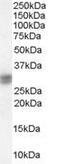 Siah E3 Ubiquitin Protein Ligase 1 antibody, PA5-17998, Invitrogen Antibodies, Western Blot image 