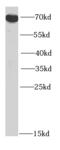 Zinc Finger DHHC-Type Containing 17 antibody, FNab03868, FineTest, Western Blot image 