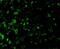DNA Fragmentation Factor Subunit Alpha antibody, GTX31638, GeneTex, Immunohistochemistry paraffin image 